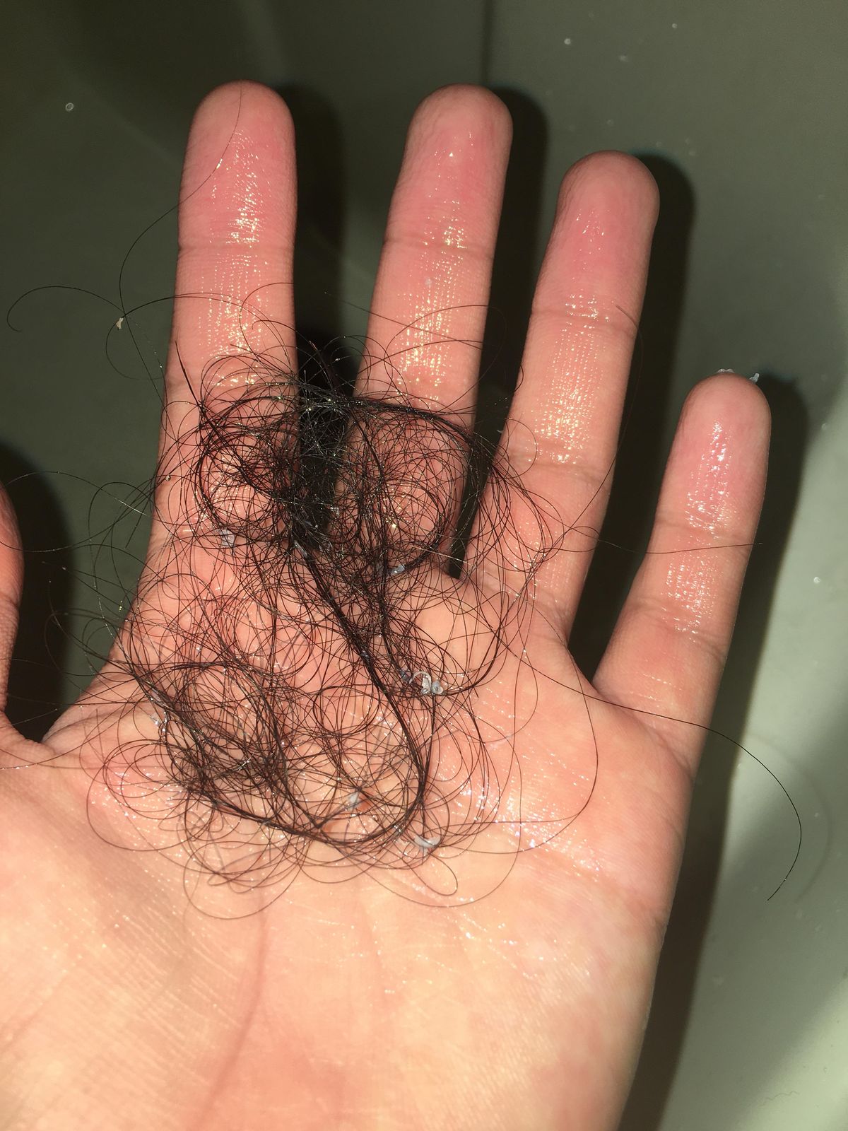 Herbal Anti - Dandruff (Hair Growth Shampoo + Conditioner) 300ML for Male & Female ⭐⭐⭐⭐⭐