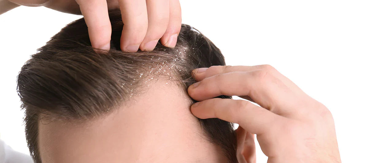 Herbal Anti - Dandruff (Hair Growth Shampoo + Conditioner) 300ML for Male & Female ⭐⭐⭐⭐⭐